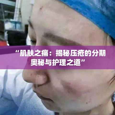 “肌肤之痛:揭秘压疮的分期奥秘与护理之道”