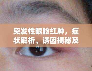 突发性眼睑红肿,症状解析、诱因揭秘及应对良方