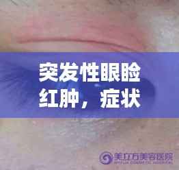 突发性眼睑红肿,症状解析、诱因揭秘及应对良方