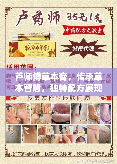 芦师傅草本膏,传承草本智慧,独特配方展现魅力