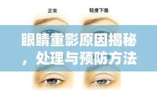 眼睛重影原因揭秘,处理与预防方法来了!
