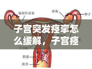 子宫突发痉挛怎么缓解,子宫痉挛怎么快速缓解