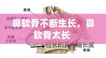 鼻软骨不断生长,鼻软骨太长