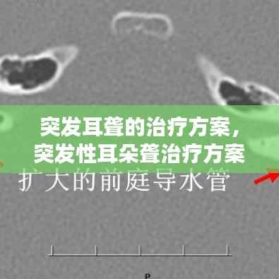 突发耳聋的治疗方案,突发性耳朵聋治疗方案
