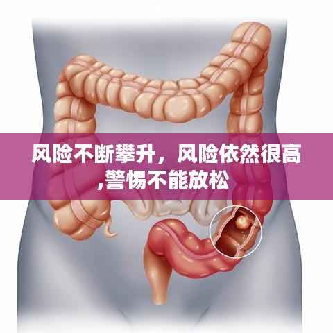 风险不断攀升，风险依然很高,警惕不能放松 