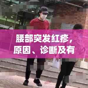 腰部突发红疹，原因、诊断及有效治疗方法全解析