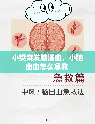 小樊突发脑溢血,小脑出血怎么急救