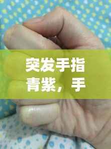 突发手指青紫,手指变青紫后又而且还疼
