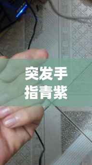 突发手指青紫,手指变青紫后又而且还疼