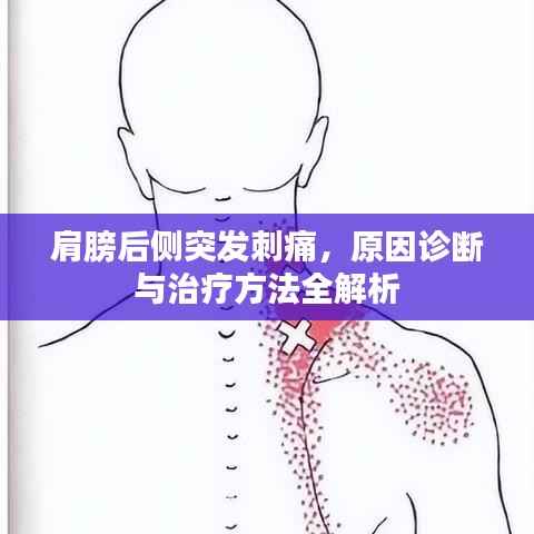 肩膀后侧突发刺痛，原因诊断与治疗方法全解析