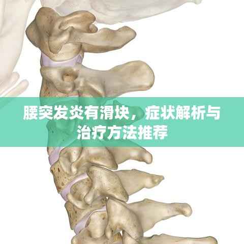 腰突发炎有滑块,症状解析与治疗方法推荐