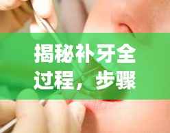 揭秘补牙全过程,步骤、注意事项一网打尽