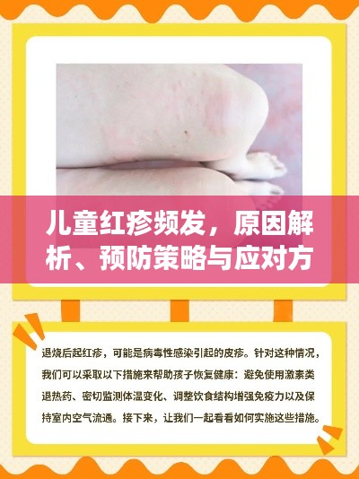 儿童红疹频发,原因解析、预防策略与应对方法
