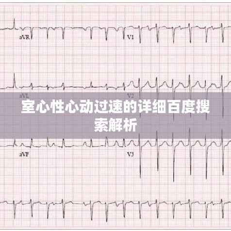 室心性心动过速的详细百度搜索解析