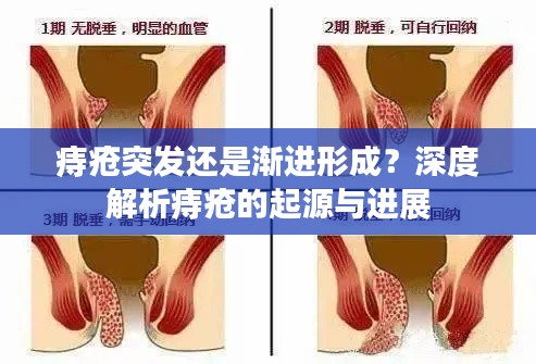 痔疮突发还是渐进形成?深度解析痔疮的起源与进展