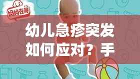 幼儿急疹突发如何应对?手术前紧急处理指南!