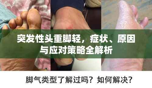 突发性头重脚轻,症状、原因与应对策略全解析