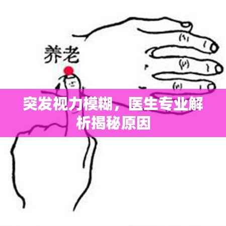 突发视力模糊,医生专业解析揭秘原因