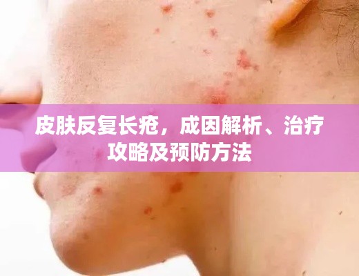 皮肤反复长疮,成因解析、治疗攻略及预防方法